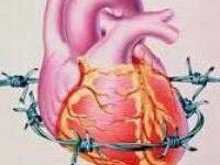 Сердечная стенокардия